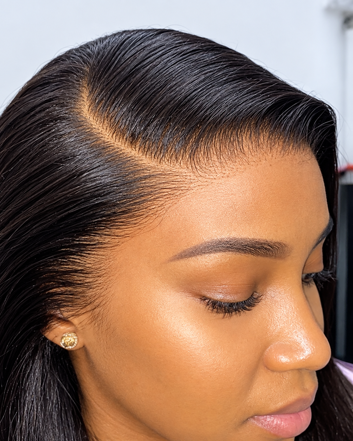 Frontals